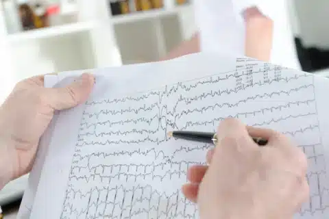 Derivações Contíguas no ECG: Uma Visão Profunda