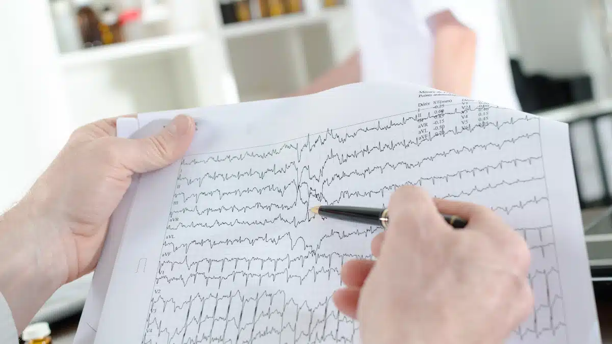 Derivações Contíguas no ECG: Uma Visão Profunda