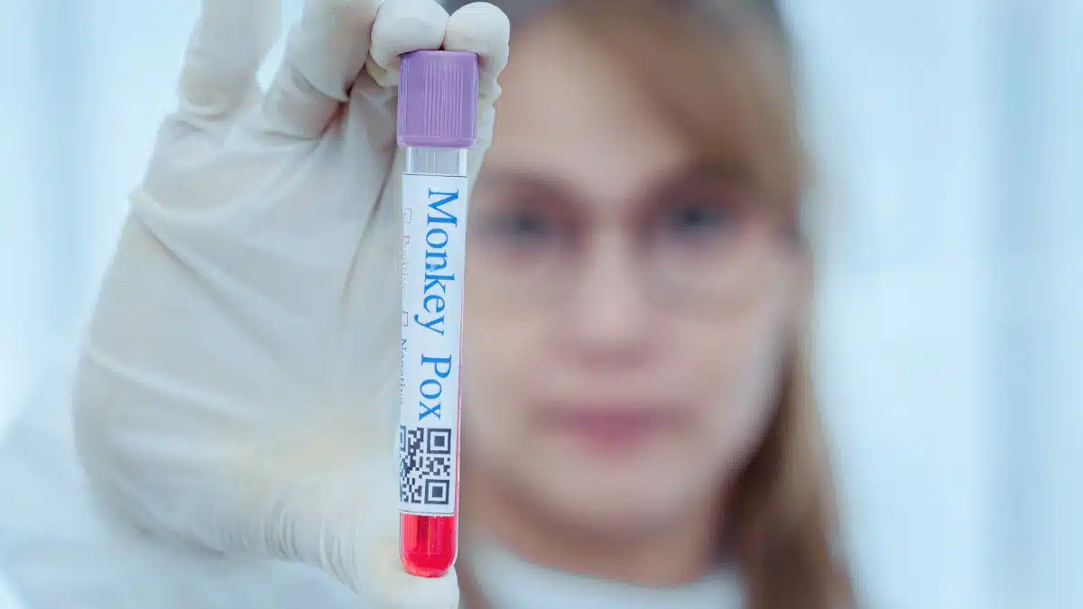 Avanço na Vacina Nacional Contra a Mpox: Um Marco na Autossuficiência Brasileira em Saúde
