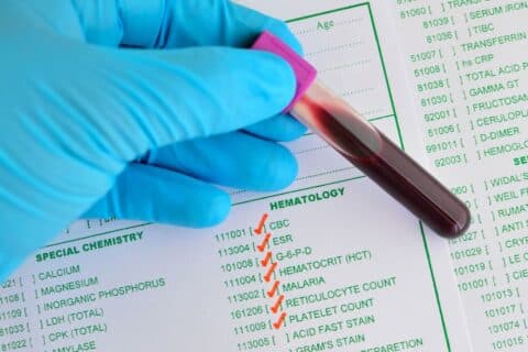 Exame físico em pacientes com alterações hematológicas