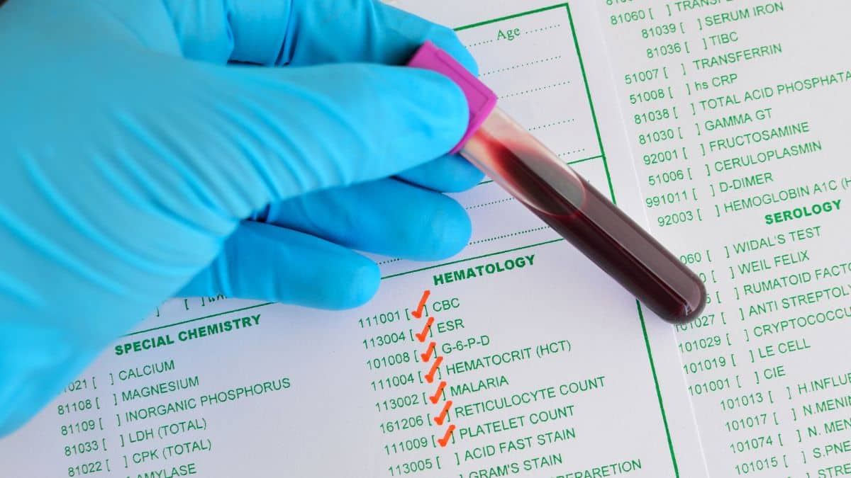 Exame físico em pacientes com alterações hematológicas
