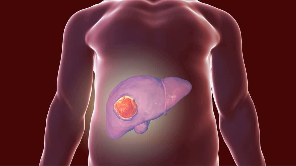 Exame físico em pacientes com distúrbios hepáticos