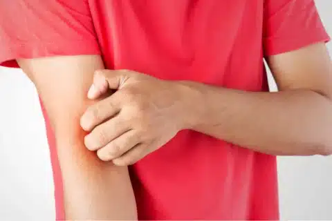 Hiperemia aumento do fluxo sanguíneo em uma região