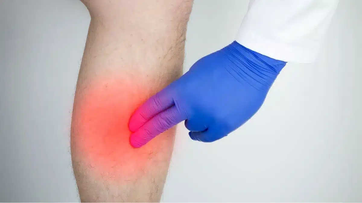 Testes para identificar sinais de inflamação e lesões ósseas