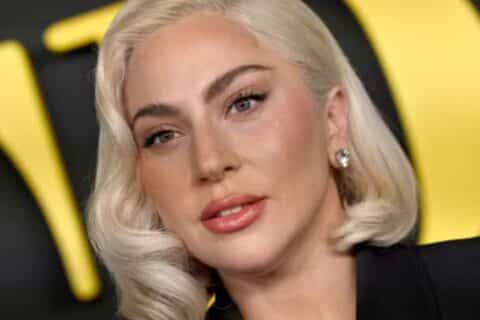 A doença que levou Lady Gaga a cancelar show no Brasil em 2017