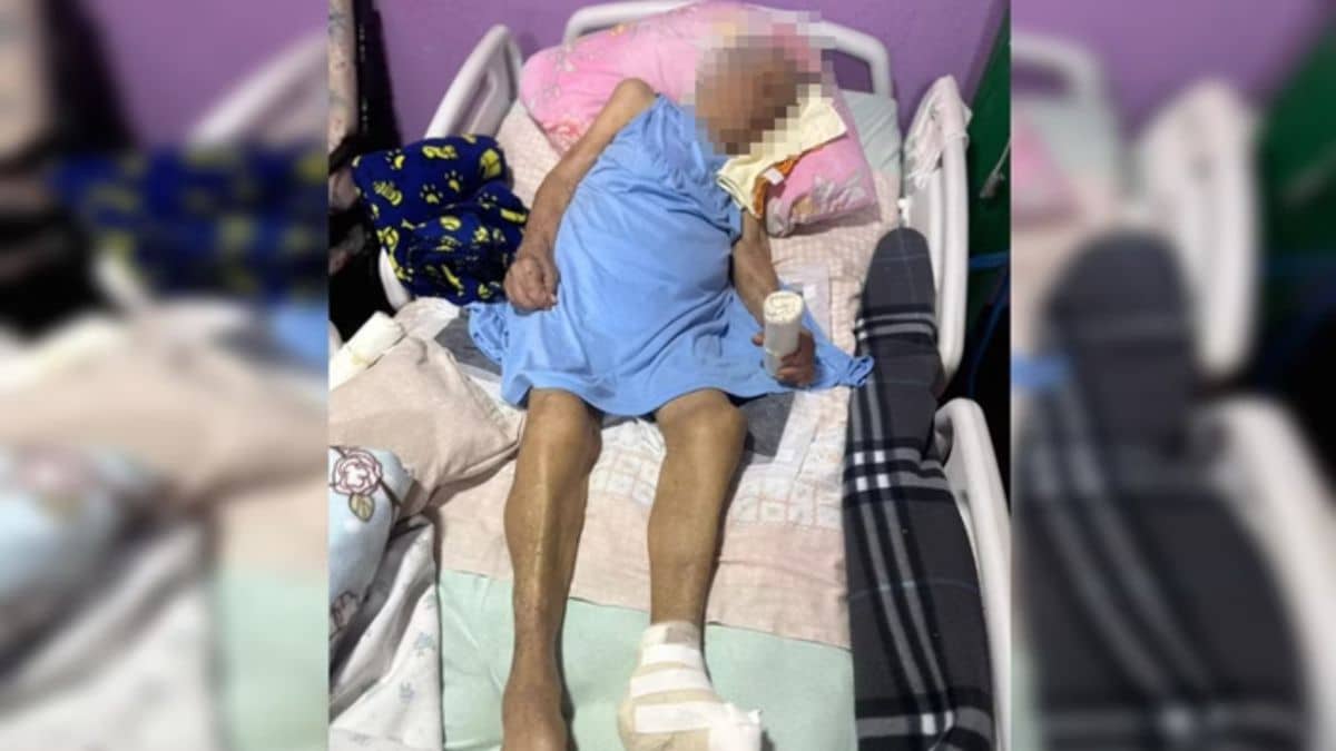 Idosa de 103 anos tem pé amputado por enfermeira sem anestesia; caso gera indignação nas redes sociais