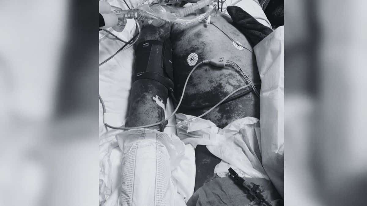 Menino morre após contrair Bactéria: Família acusa Hospital de Negligência