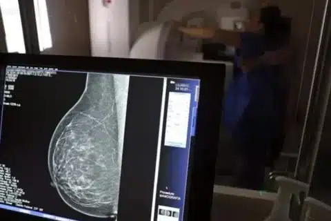 Planos-de-saúde-são-obrigados-a-cobrir-mamografias-para-todas-as-idades_-reforça-ANS