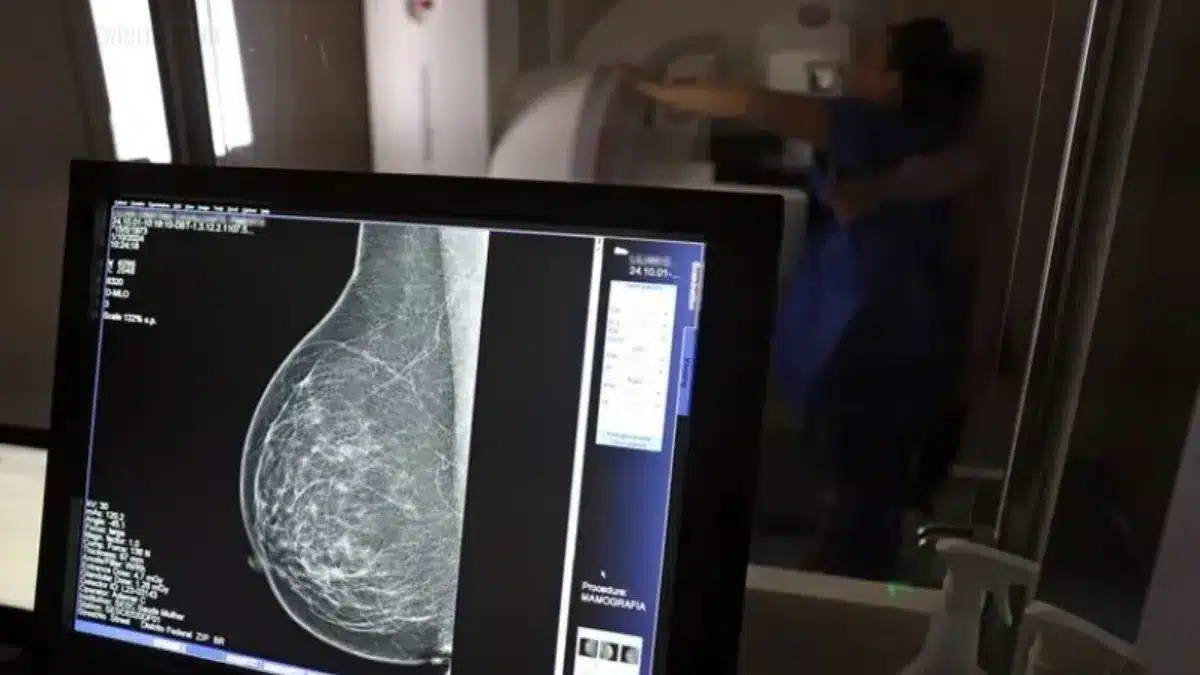 Planos-de-saúde-são-obrigados-a-cobrir-mamografias-para-todas-as-idades_-reforça-ANS