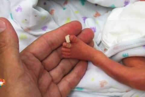 Por que o Brasil está entre os Líderes em Nascimentos Prematuros?
