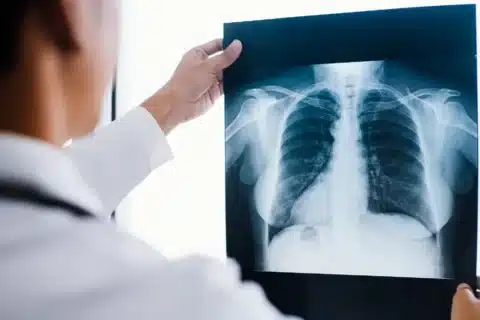 Prefeitura de Balsa Nova trabalha para reinstalar Raio X no Centro Médico Bom Jesus