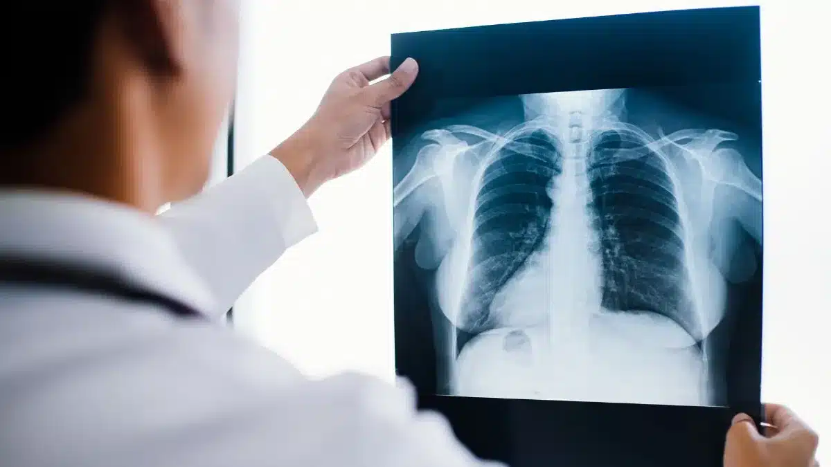 Prefeitura de Balsa Nova trabalha para reinstalar Raio X no Centro Médico Bom Jesus