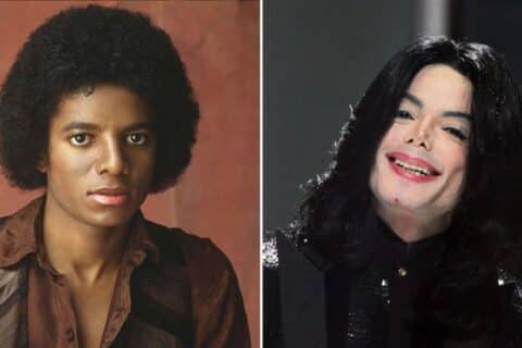 Quando Michael Jackson começou a clarear a pele? A verdade sobre o Vitiligo