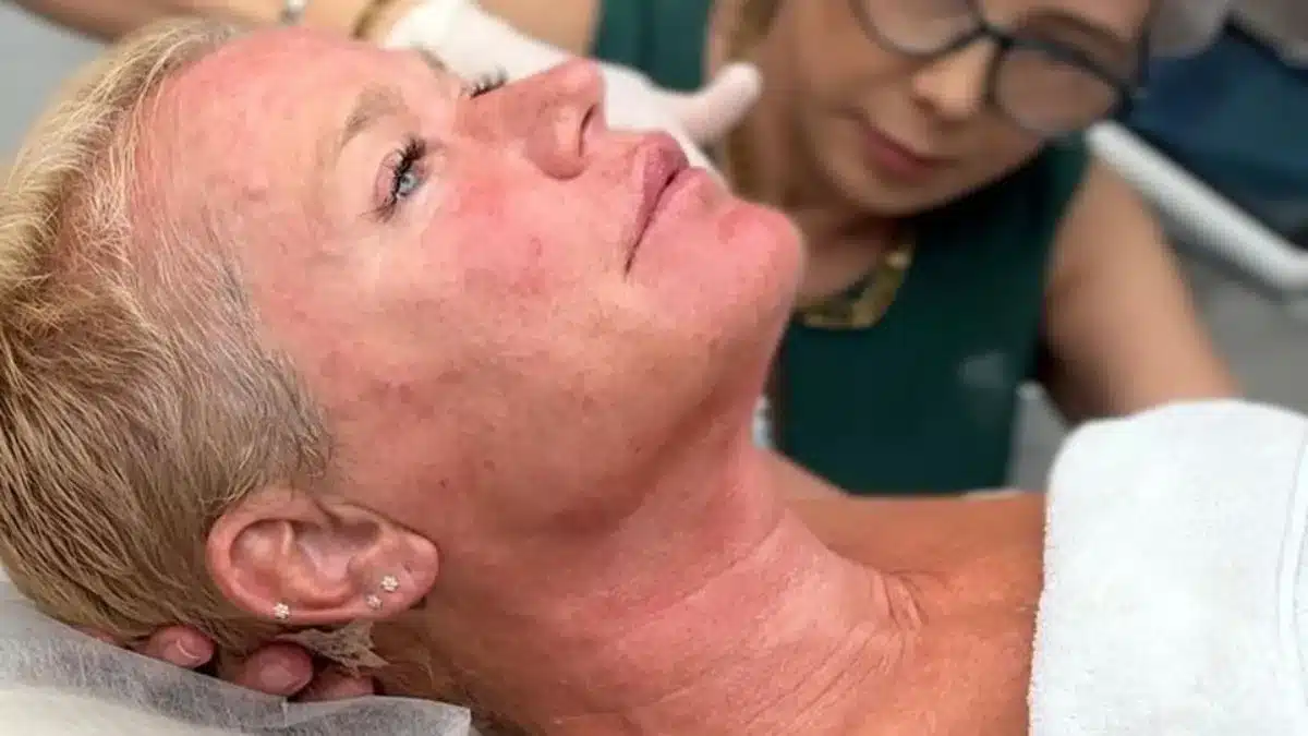 Xuxa Meneghel se recupera em casa após ser internada para cirurgia no joelho em São Paulo