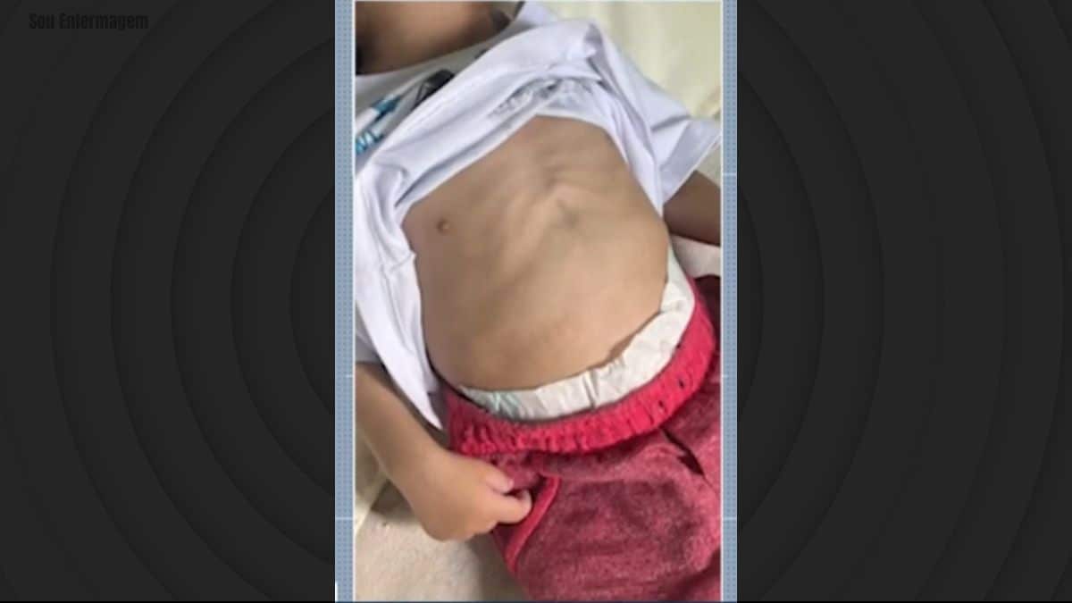 Bebê de um ano morre em hospital na Bahia com sinais de desnutrição e agressão; pais são presos