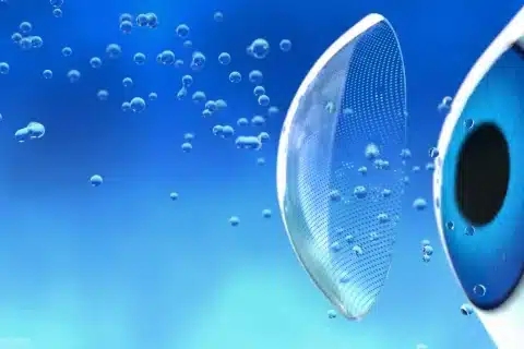 Paciente-descobre-cinco-lentes-de-contato-presas-no-olho-após-buscar-cirurgia-plástica