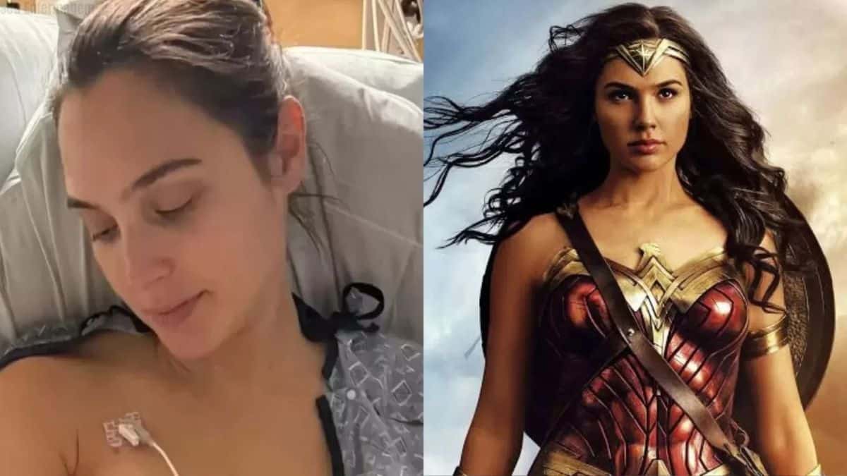 Complicação na gravidez coágulo cerebral de Gal Gadot acende alerta para a saúde materna