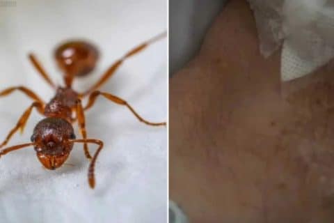Idosa é picada por dezenas de formigas enquanto estava internada em hospital particular de Sorocaba