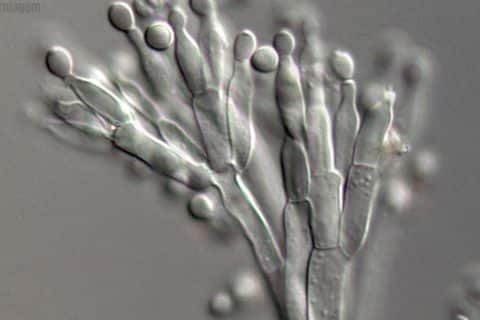 Alerta sanitário é emitido para Sudeste e Nordeste diante da ameaça crescente do superfungo Candida auris