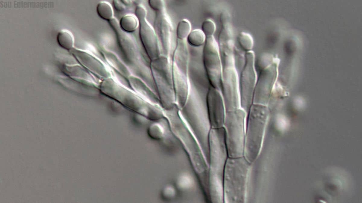 Alerta sanitário é emitido para Sudeste e Nordeste diante da ameaça crescente do superfungo Candida auris