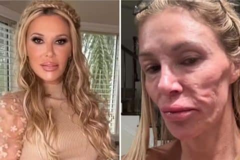 Ex-modelo enfrenta deterioração facial e sintomas misteriosos em luta por diagnóstico “Sinto algo vivo dentro de mim”