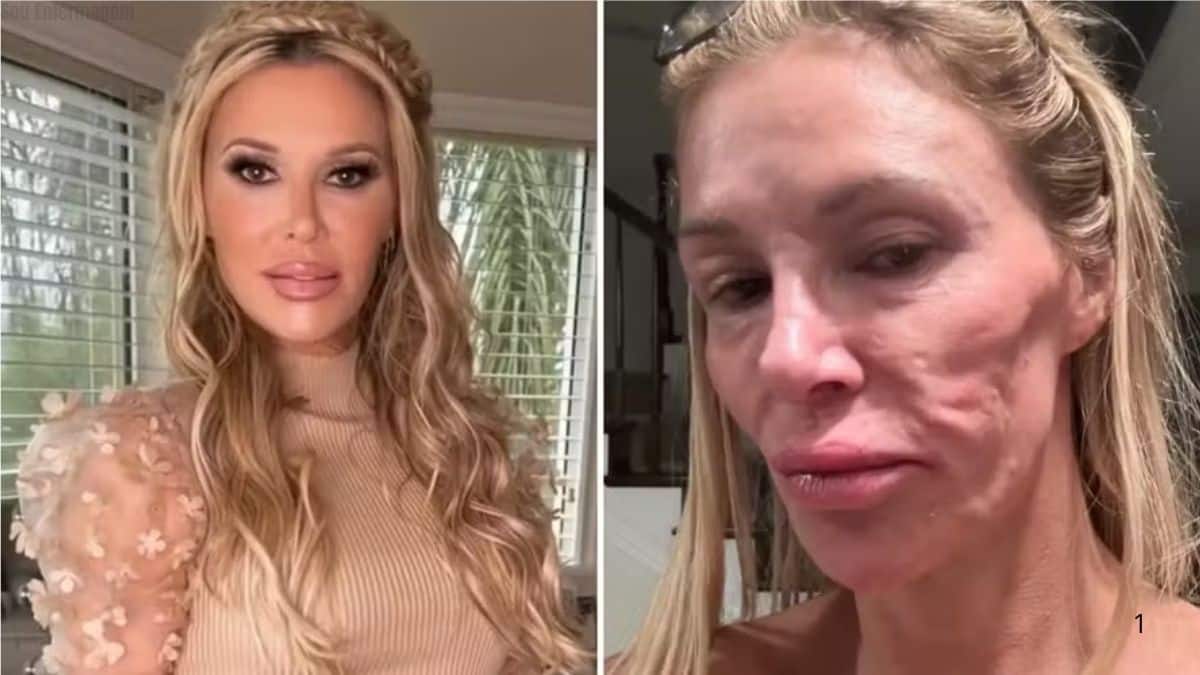 Ex-modelo enfrenta deterioração facial e sintomas misteriosos em luta por diagnóstico “Sinto algo vivo dentro de mim”