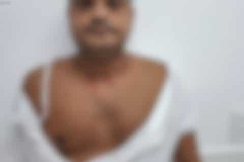 Médico e enfermeira são atacados por paciente e unidade de saúde é interditada em Blumenau