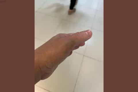 Técnica de enfermagem é agredida por pai de recém-nascida durante procedimento em hospital de São Luís
