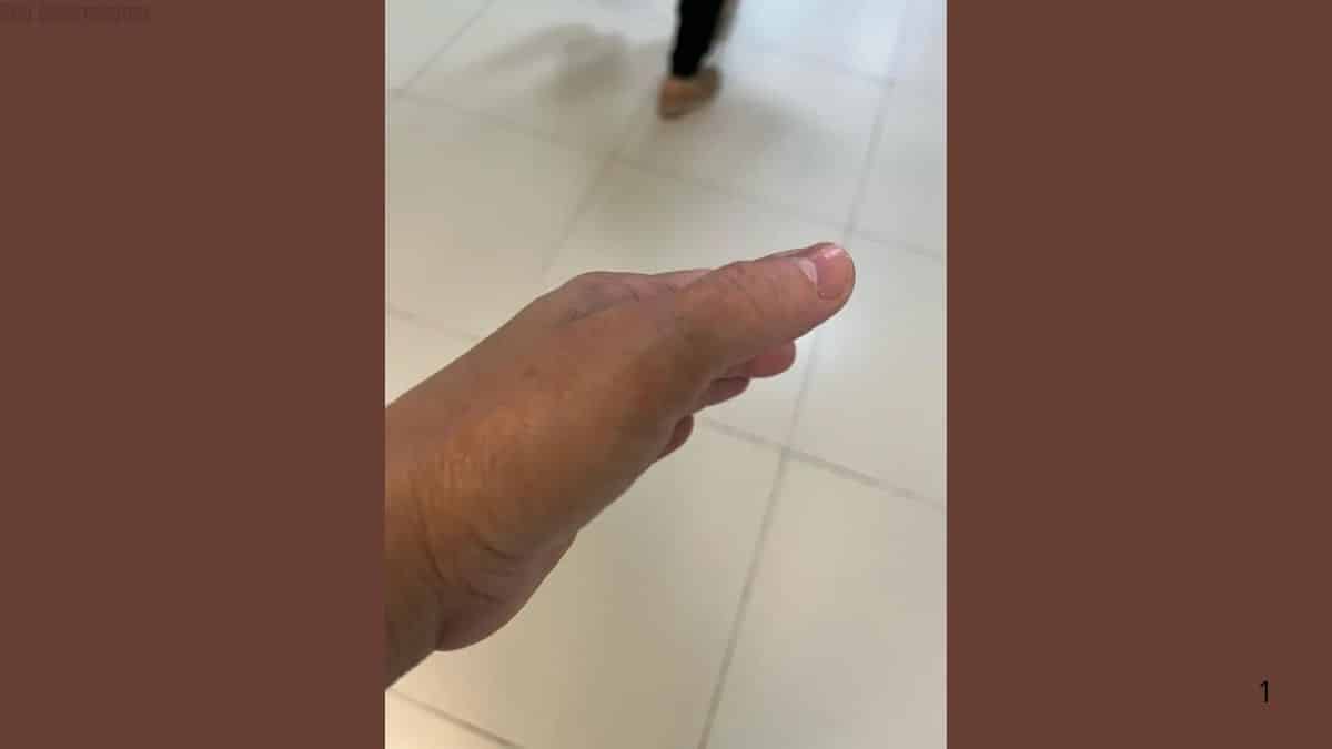 Técnica de enfermagem é agredida por pai de recém-nascida durante procedimento em hospital de São Luís