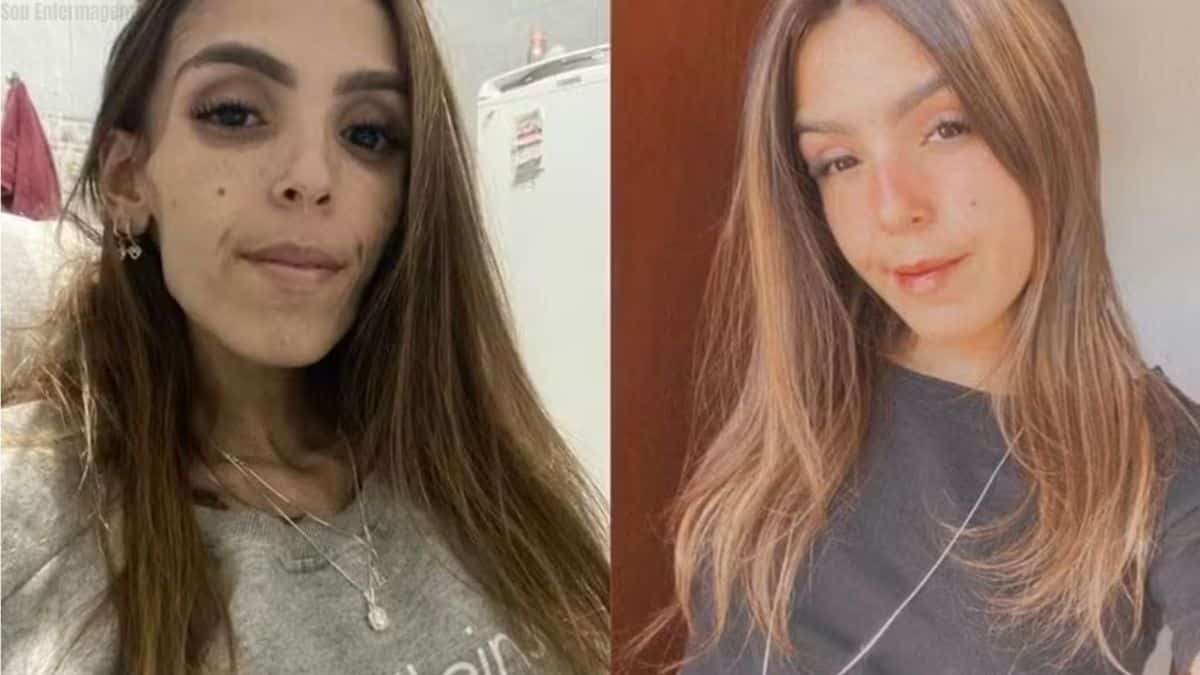 Jovem de Viçosa morre aos 22 anos após longa batalha contra doença rara que causava desnutrição extrema