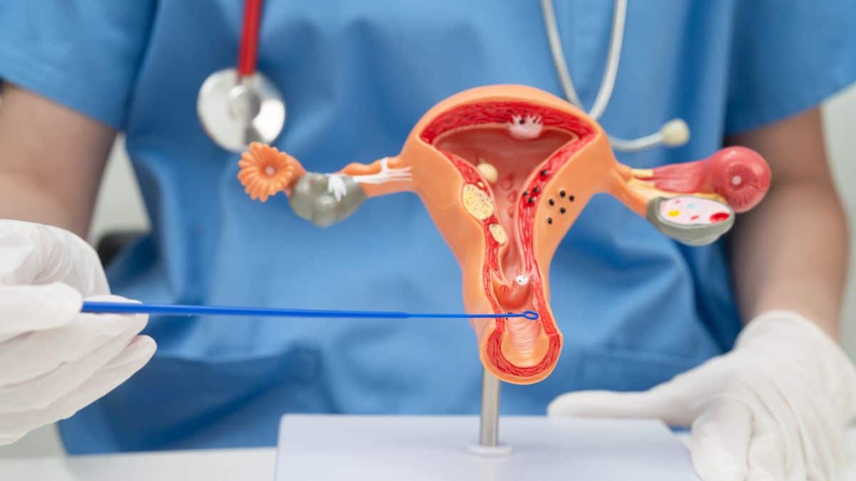 Guia atualizado aponta evolução no rastreamento do HPV no país