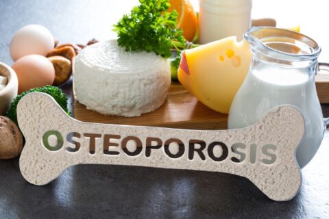 Hábitos Essenciais para Prevenir a Osteoporose antes dos 50 anos
