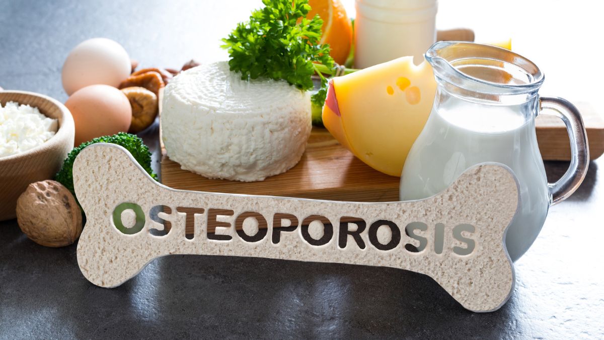 Hábitos Essenciais para Prevenir a Osteoporose antes dos 50 anos