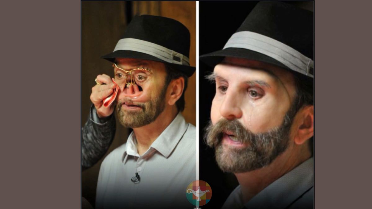 “Salvar o rosto para salvar a vida”: a história real de Donnie Fritts e o câncer que destruiu seu rosto por dentro