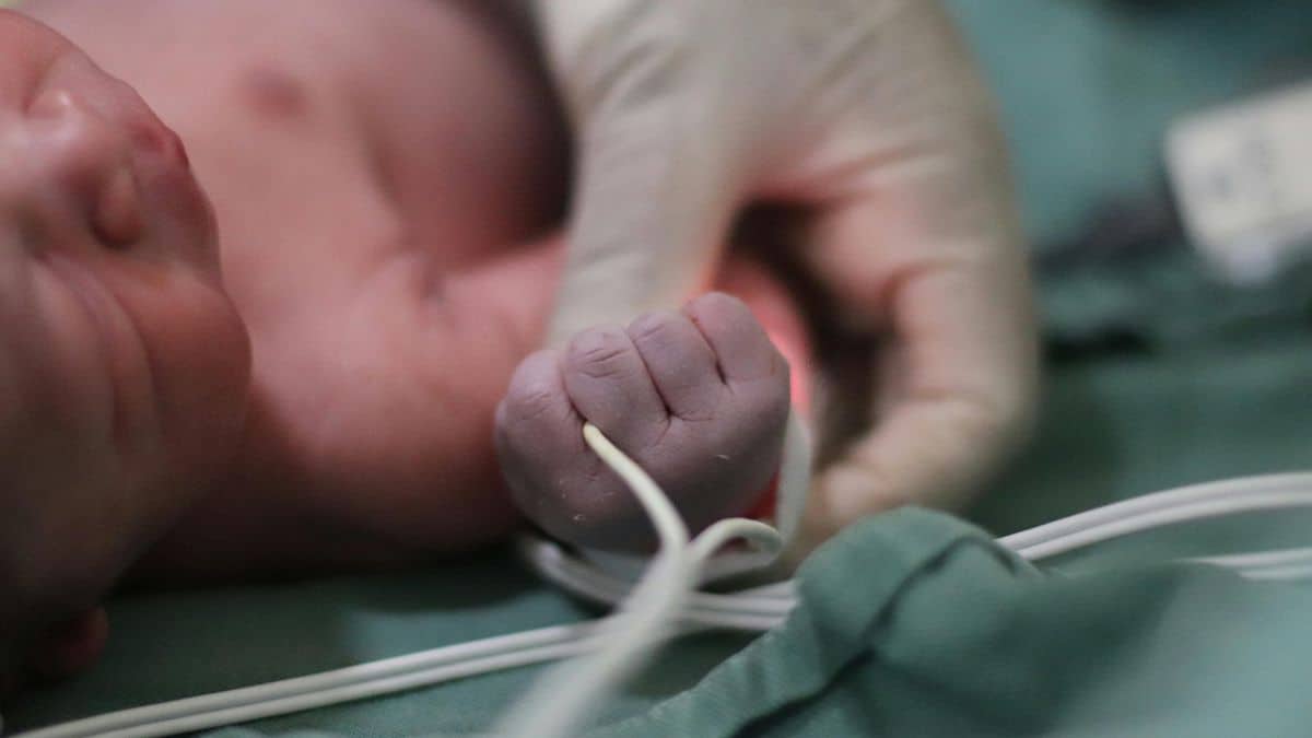 Tecnologia monitora atividade cerebral de bebês na Santa Casa BH