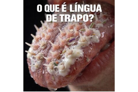 O Impacto Invisível da Língua de Trapo na Saúde Mental