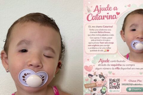 Criança de Jaraguá do Sul, SC, precisa de ajuda para cirurgia; saiba mais