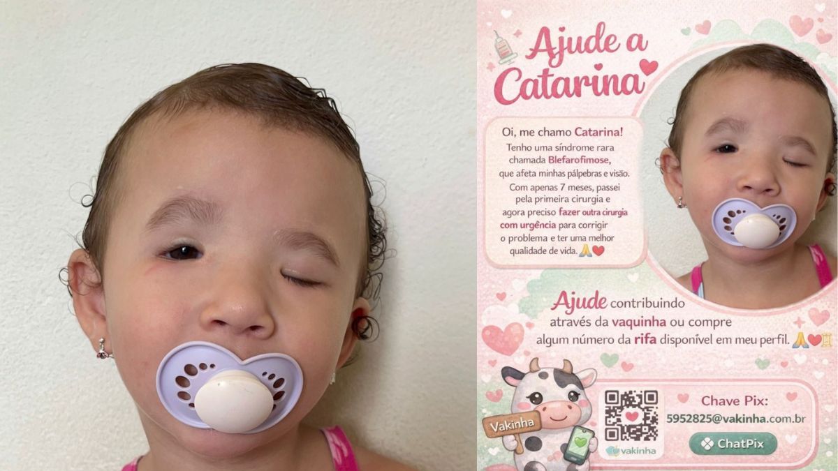 Criança de Jaraguá do Sul, SC, precisa de ajuda para cirurgia; saiba mais