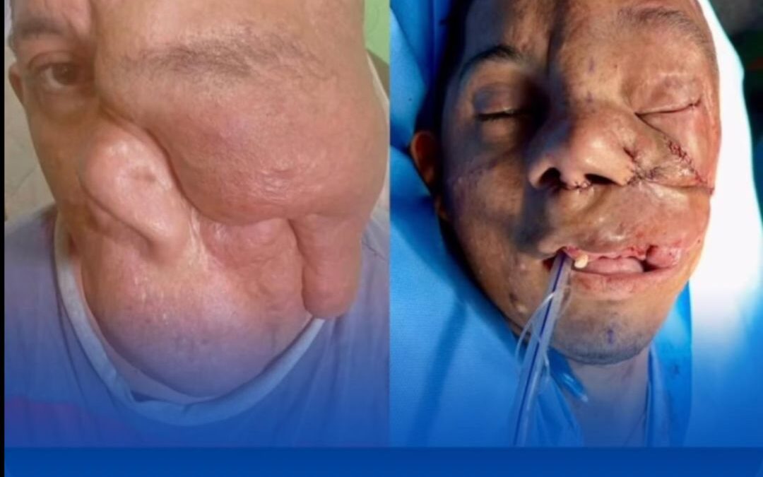 José Wellington passa por 4ª cirurgia em Goiânia e apresenta evolução positiva