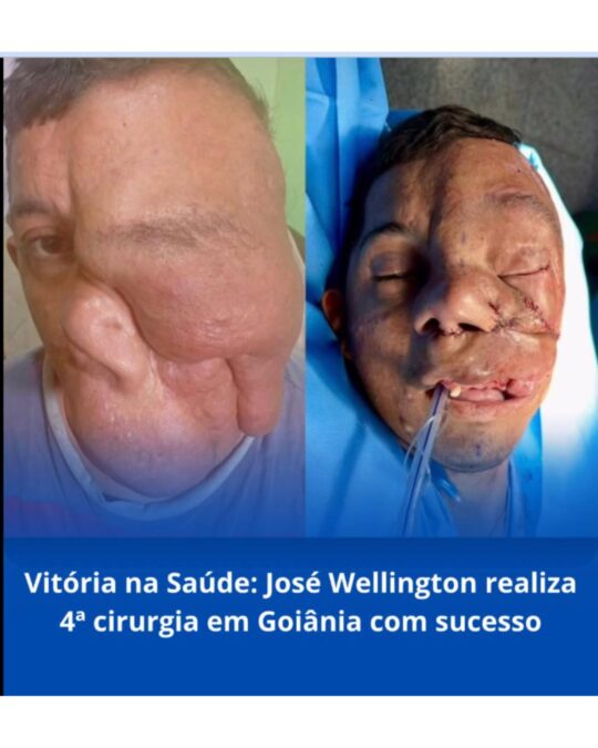 José Wellington passa por 4ª cirurgia em Goiânia e apresenta evolução positiva