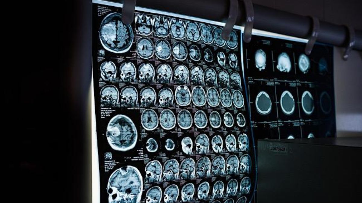 Hospital e município de SC devem pagar indenização a trabalhador com sequelas neurológicas